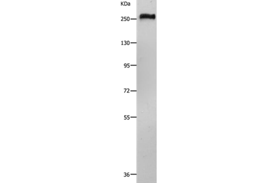 ACIN1 Antibody from Signalway Antibody (36725) - Antibodies.com