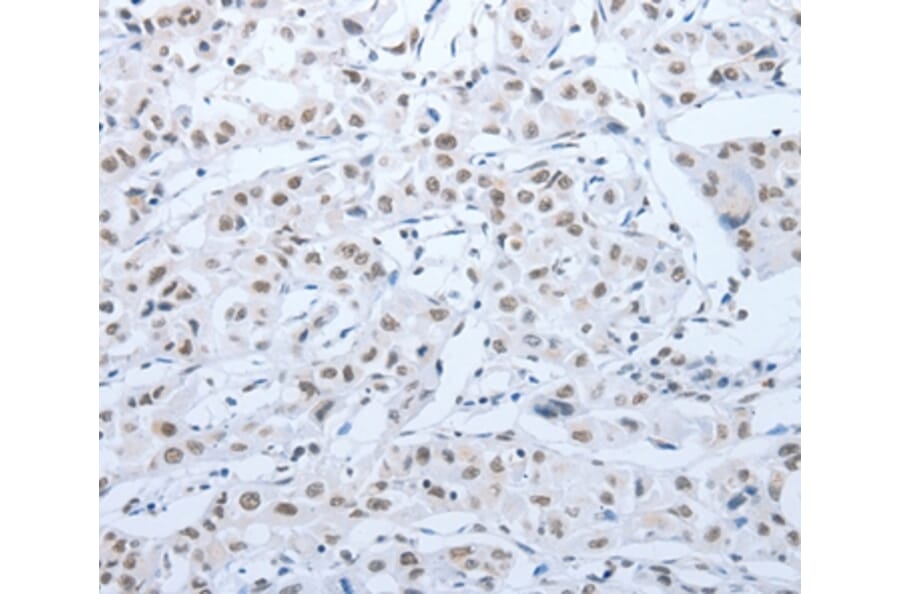 Immunohistochemistry - ACIN1 Antibody from Signalway Antibody (36725) - Antibodies.com