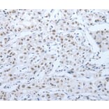 Immunohistochemistry - ACIN1 Antibody from Signalway Antibody (36725) - Antibodies.com