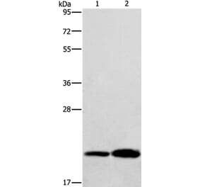 RAB26 Antibody from Signalway Antibody (36734) - Antibodies.com