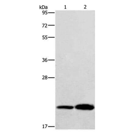RAB26 Antibody from Signalway Antibody (36734) - Antibodies.com