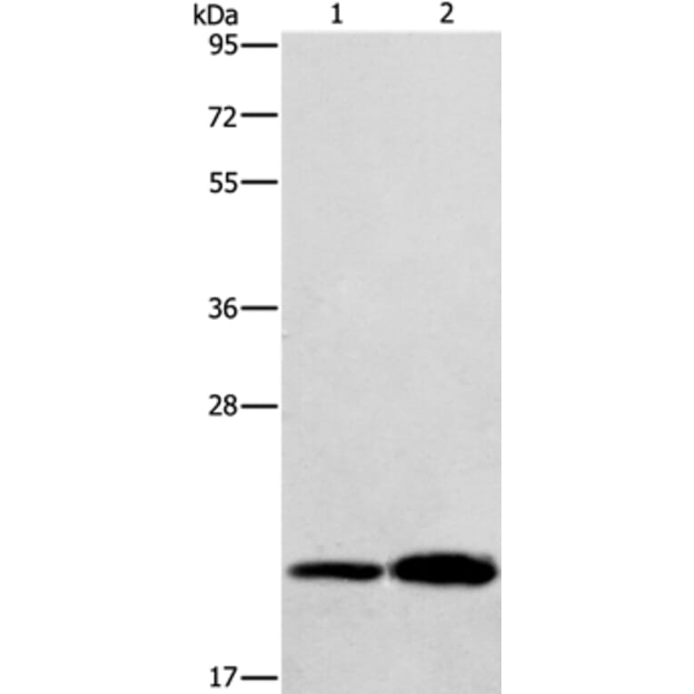 RAB26 Antibody from Signalway Antibody (36734) - Antibodies.com