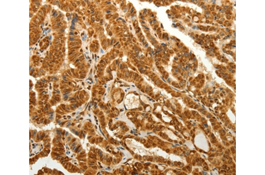 Immunohistochemistry - RAB26 Antibody from Signalway Antibody (36734) - Antibodies.com