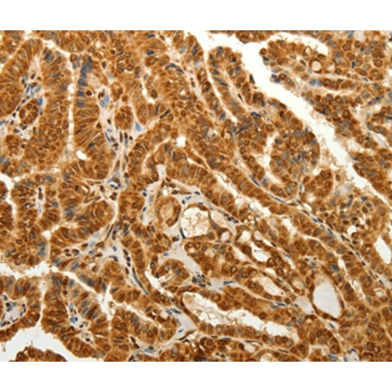 Immunohistochemistry - RAB26 Antibody from Signalway Antibody (36734) - Antibodies.com