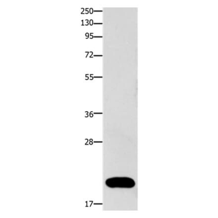 FABP3 Antibody from Signalway Antibody (36748) - Antibodies.com