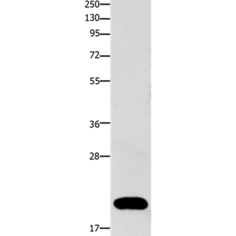 FABP3 Antibody from Signalway Antibody (36748) - Antibodies.com