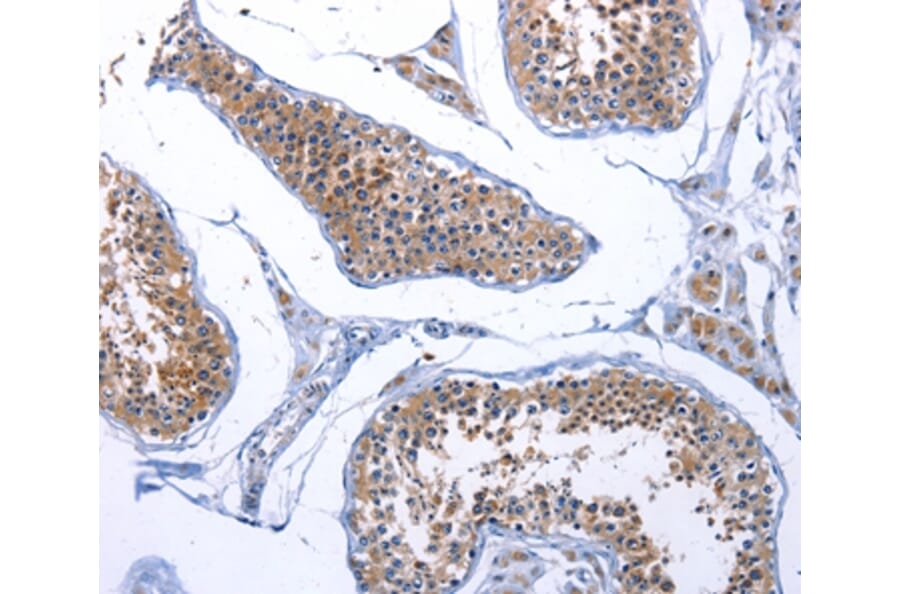 Immunohistochemistry - FABP3 Antibody from Signalway Antibody (36748) - Antibodies.com