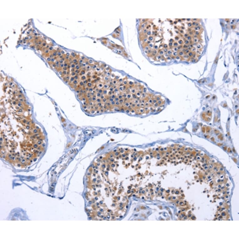 Immunohistochemistry - FABP3 Antibody from Signalway Antibody (36748) - Antibodies.com