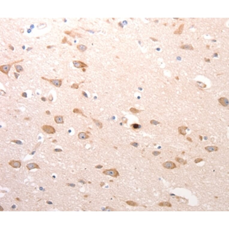 Immunohistochemistry - CDC37 Antibody from Signalway Antibody (36786) - Antibodies.com