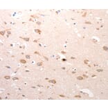 Immunohistochemistry - CDC37 Antibody from Signalway Antibody (36786) - Antibodies.com