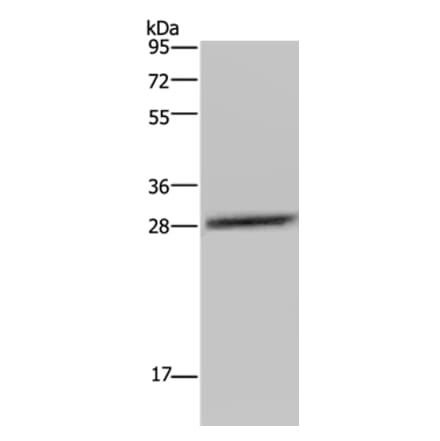 CEBPD Antibody from Signalway Antibody (36790) - Antibodies.com