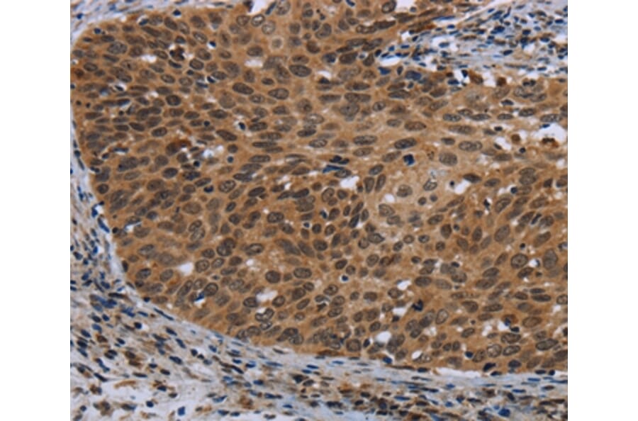 Immunohistochemistry - CEBPD Antibody from Signalway Antibody (36790) - Antibodies.com