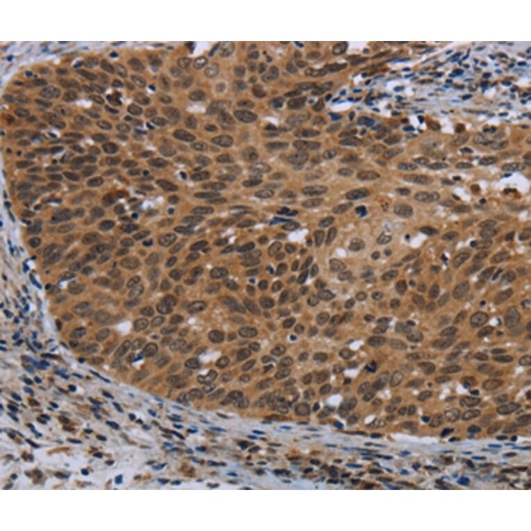 Immunohistochemistry - CEBPD Antibody from Signalway Antibody (36790) - Antibodies.com