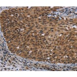 Immunohistochemistry - CEBPD Antibody from Signalway Antibody (36790) - Antibodies.com