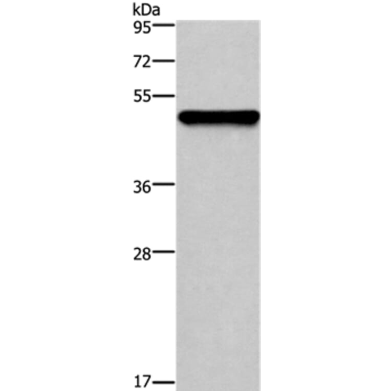 KRT14 Antibody from Signalway Antibody (36794) - Antibodies.com
