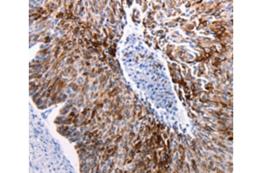 Immunohistochemistry - KRT14 Antibody from Signalway Antibody (36794) - Antibodies.com