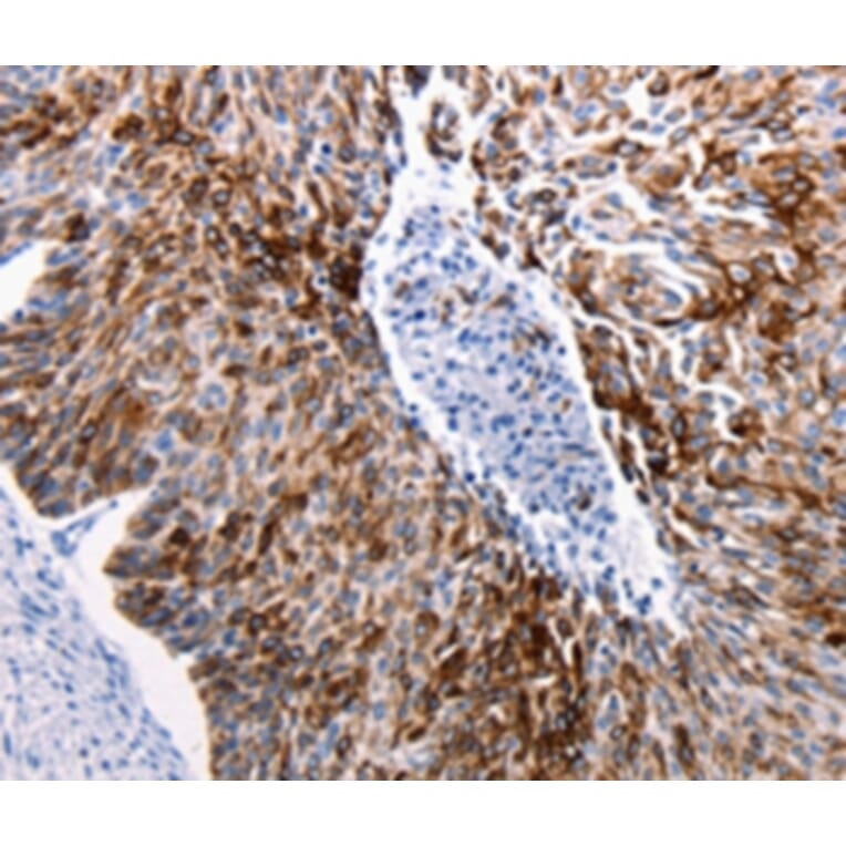 Immunohistochemistry - KRT14 Antibody from Signalway Antibody (36794) - Antibodies.com
