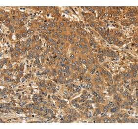 EDNRA Antibody from Signalway Antibody (36835) - Antibodies.com