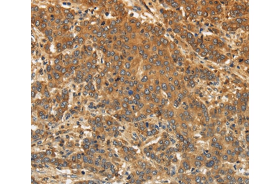 EDNRA Antibody from Signalway Antibody (36835) - Antibodies.com