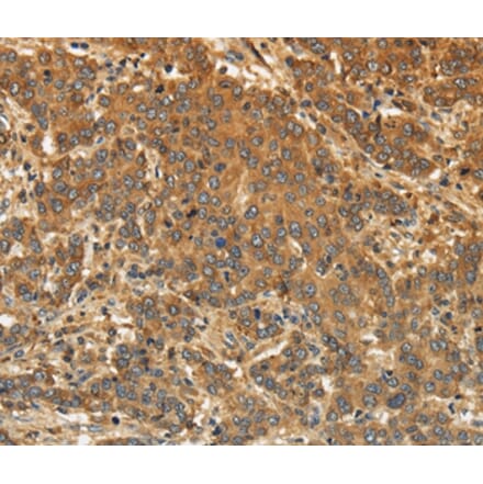 EDNRA Antibody from Signalway Antibody (36835) - Antibodies.com