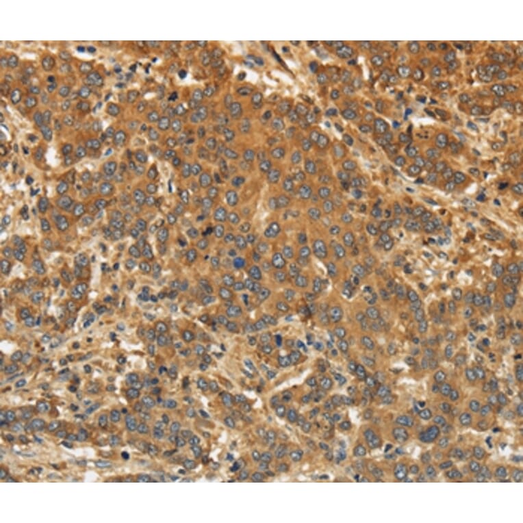EDNRA Antibody from Signalway Antibody (36835) - Antibodies.com