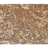 EDNRA Antibody from Signalway Antibody (36835) - Antibodies.com