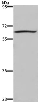 Gel: 6%SDS-PAGE Lysate: 40ug 293T cell Primary antibody: 1/200 dilution Secondary antibody dilution: 1/8000 Exposure time: 3 minutes