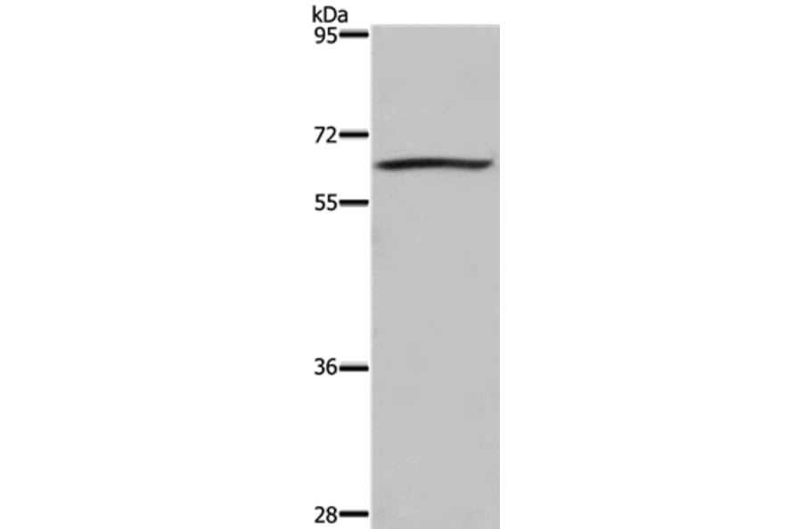 DUSP8 Antibody from Signalway Antibody (36848) - Antibodies.com