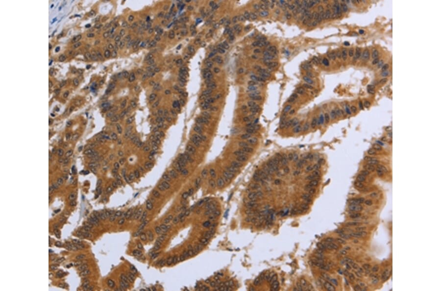 Immunohistochemistry - DUSP8 Antibody from Signalway Antibody (36848) - Antibodies.com