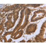 Immunohistochemistry - DUSP8 Antibody from Signalway Antibody (36848) - Antibodies.com
