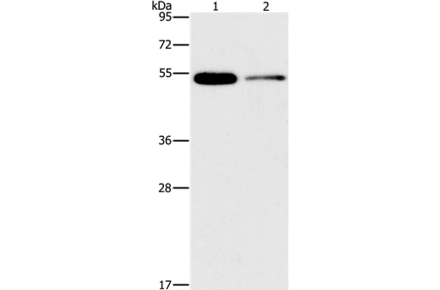 FOXF2 Antibody from Signalway Antibody (36859) - Antibodies.com