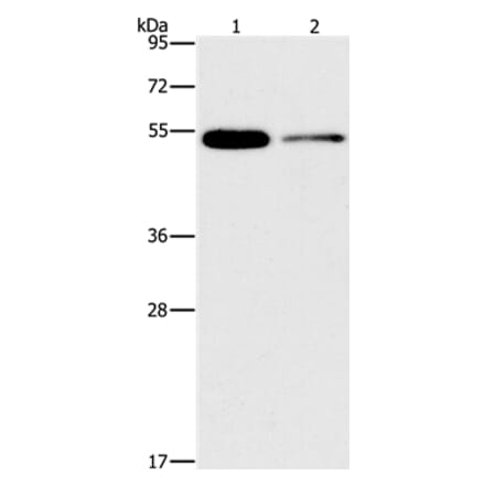 FOXF2 Antibody from Signalway Antibody (36859) - Antibodies.com