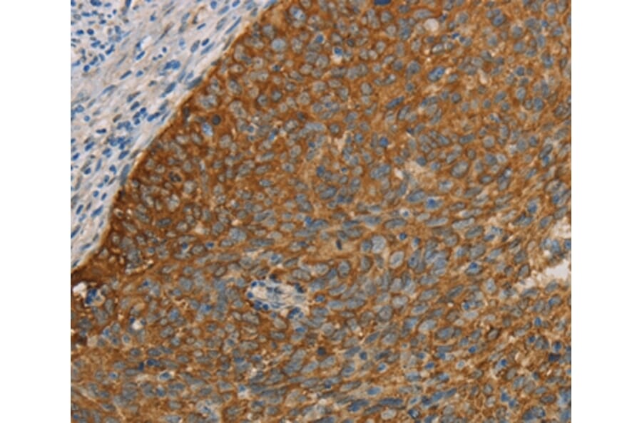 Immunohistochemistry - FOXF2 Antibody from Signalway Antibody (36859) - Antibodies.com