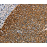 Immunohistochemistry - FOXF2 Antibody from Signalway Antibody (36859) - Antibodies.com