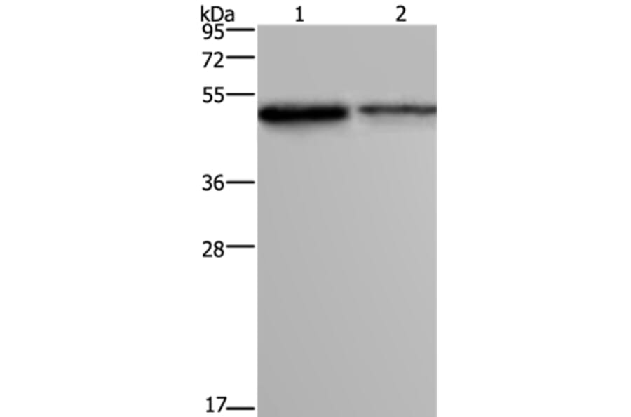 FOXA1 Antibody from Signalway Antibody (36860) - Antibodies.com