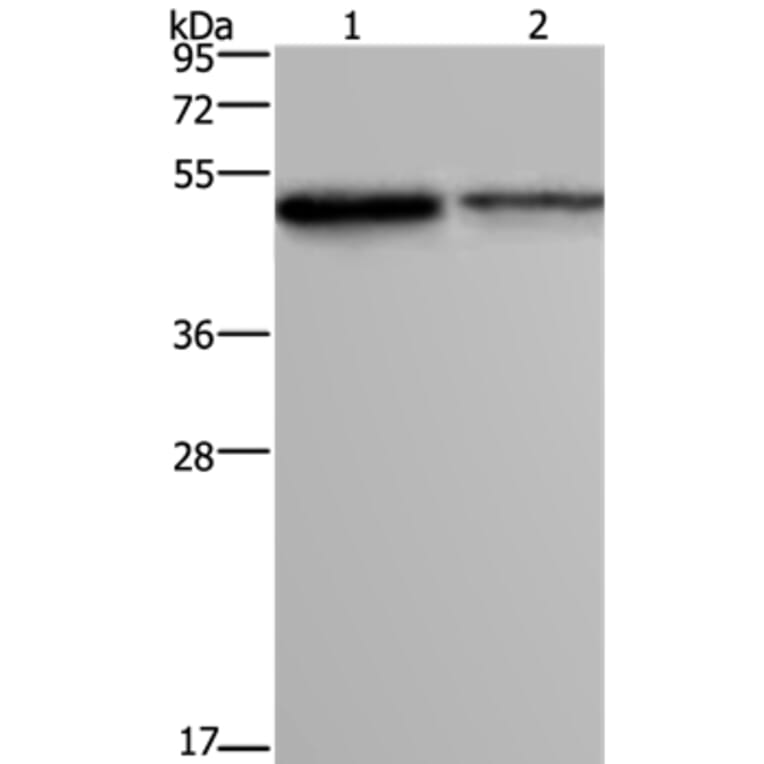 FOXA1 Antibody from Signalway Antibody (36860) - Antibodies.com