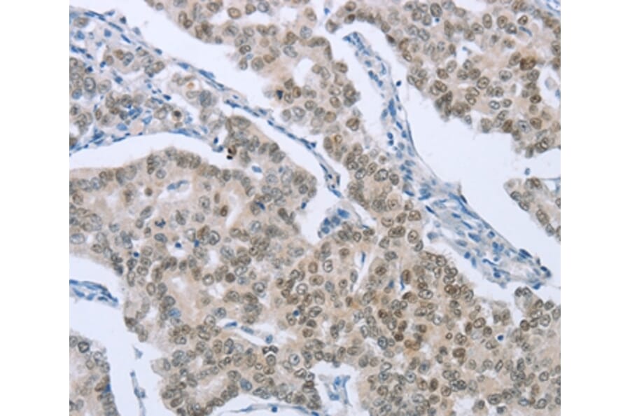 Immunohistochemistry - FOXA1 Antibody from Signalway Antibody (36860) - Antibodies.com