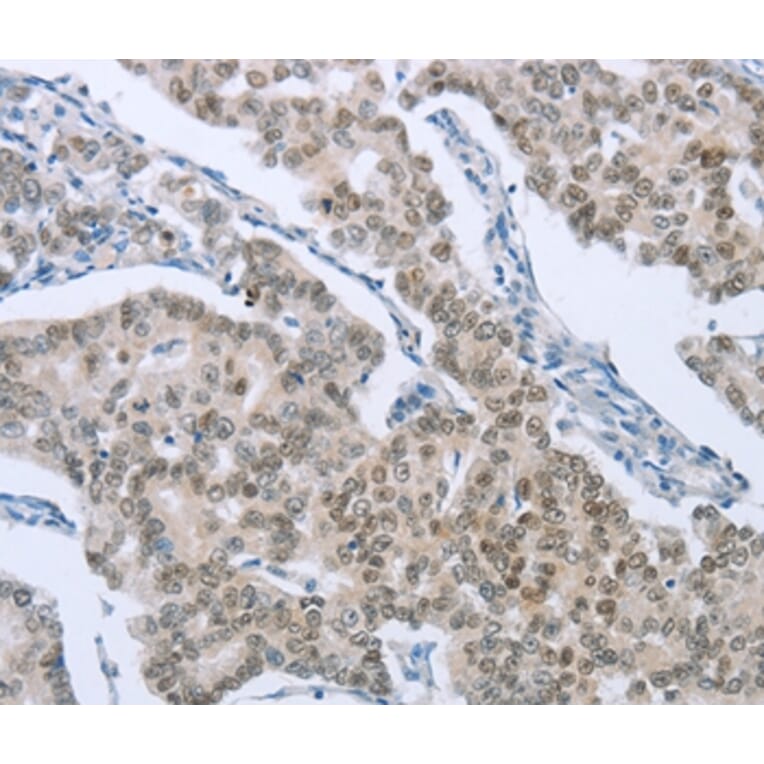 Immunohistochemistry - FOXA1 Antibody from Signalway Antibody (36860) - Antibodies.com