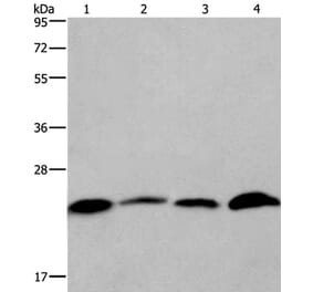 CMTM6 Antibody from Signalway Antibody (36886) - Antibodies.com