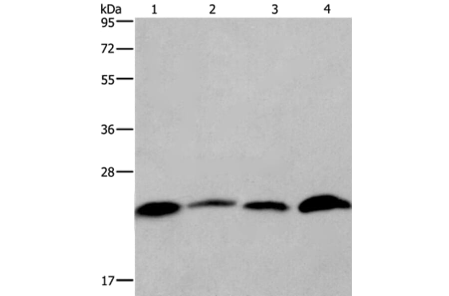 CMTM6 Antibody from Signalway Antibody (36886) - Antibodies.com