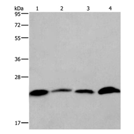 CMTM6 Antibody from Signalway Antibody (36886) - Antibodies.com