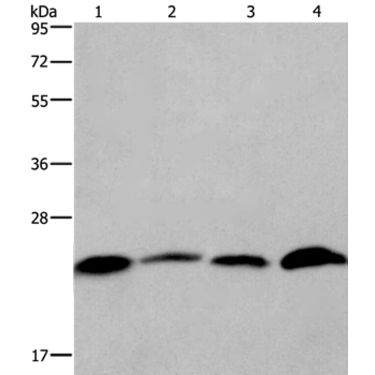 CMTM6 Antibody from Signalway Antibody (36886) - Antibodies.com