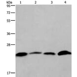 CMTM6 Antibody from Signalway Antibody (36886) - Antibodies.com