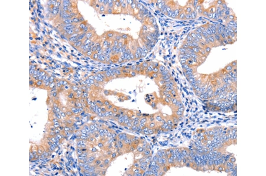 Immunohistochemistry - CMTM6 Antibody from Signalway Antibody (36886) - Antibodies.com