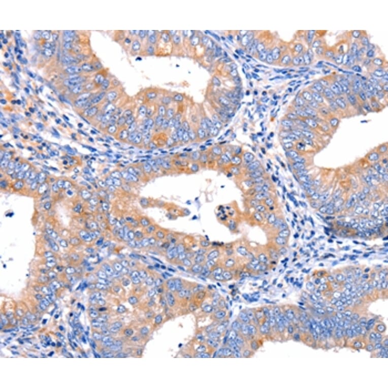 Immunohistochemistry - CMTM6 Antibody from Signalway Antibody (36886) - Antibodies.com