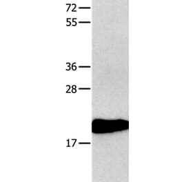 CMTM3 Antibody from Signalway Antibody (36888) - Antibodies.com