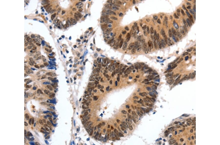 Immunohistochemistry - CMTM3 Antibody from Signalway Antibody (36888) - Antibodies.com