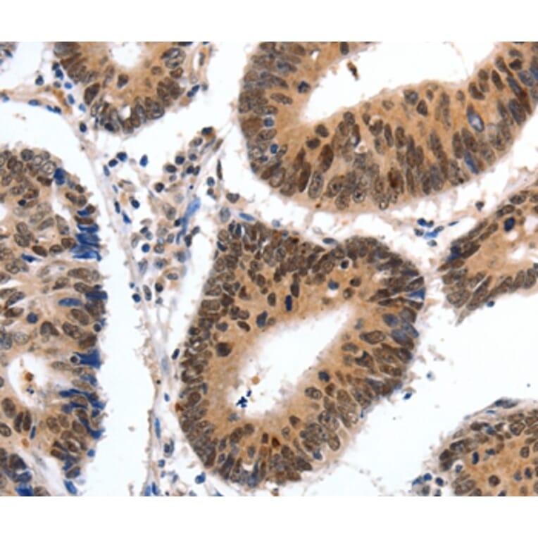 Immunohistochemistry - CMTM3 Antibody from Signalway Antibody (36888) - Antibodies.com