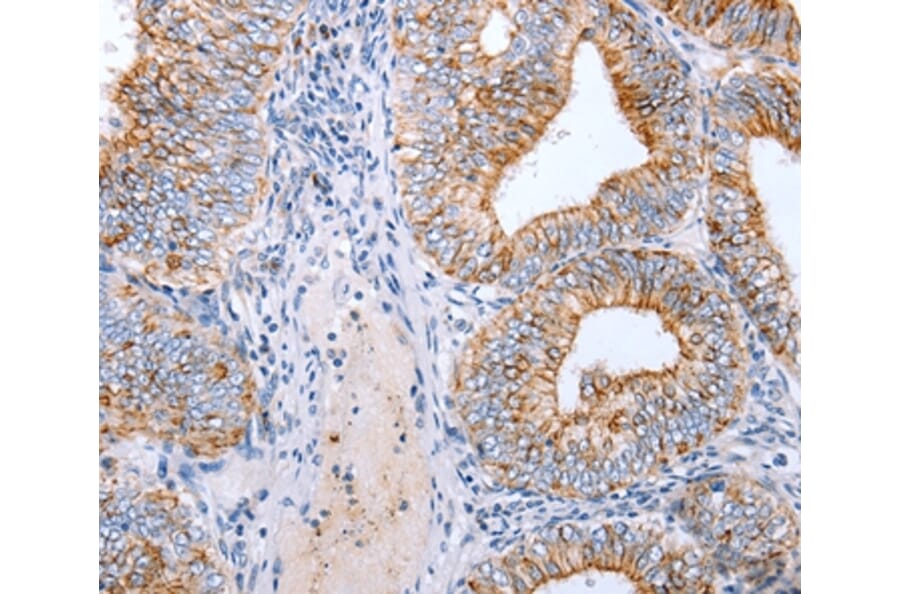 Immunohistochemistry - CLDN3 Antibody from Signalway Antibody (36889) - Antibodies.com