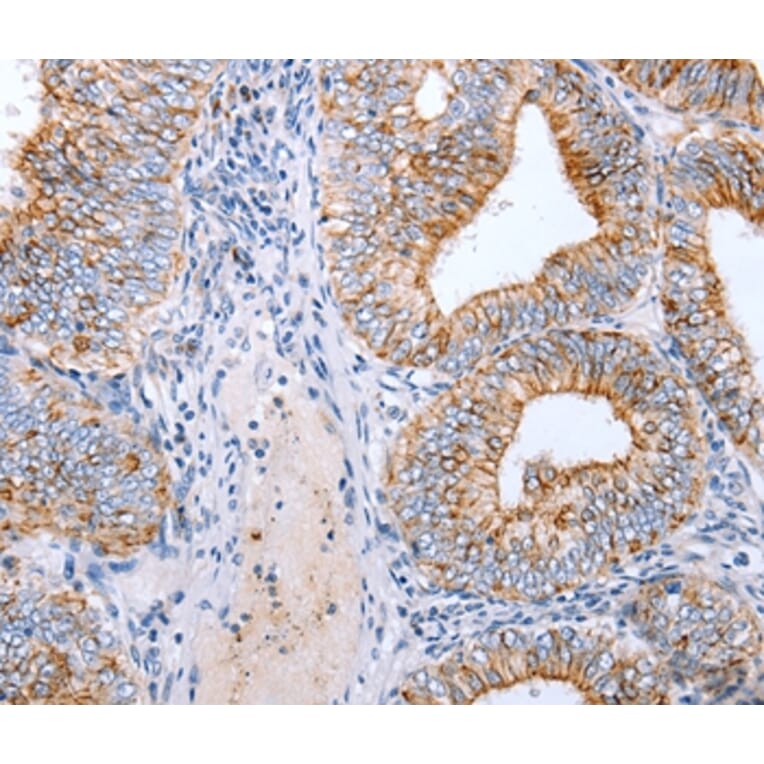 Immunohistochemistry - CLDN3 Antibody from Signalway Antibody (36889) - Antibodies.com